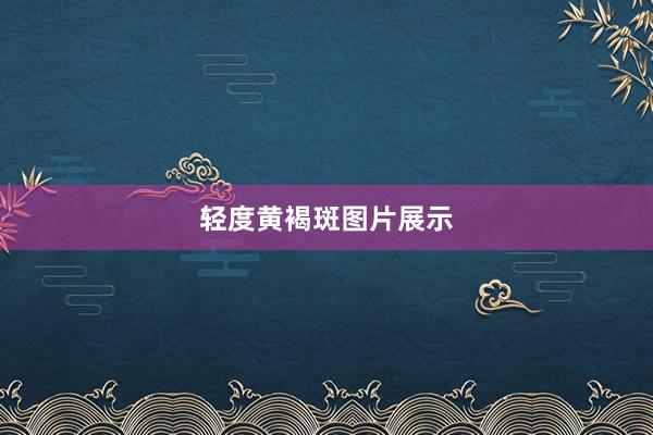 轻度黄褐斑图片展示